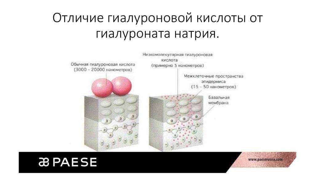Насколько эффективны инъекции гиалуроновой кислоты в суставы: что говорит статистика - нолтрекс.